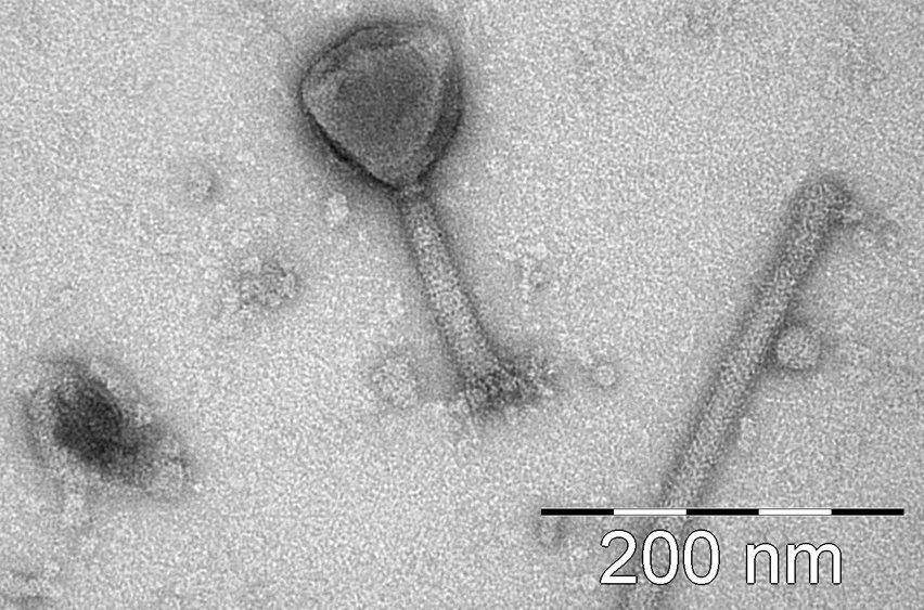 Bakteriofager som inficerer Salmonella fotograferet via et transmissions-elektronmikroskop (TEM).