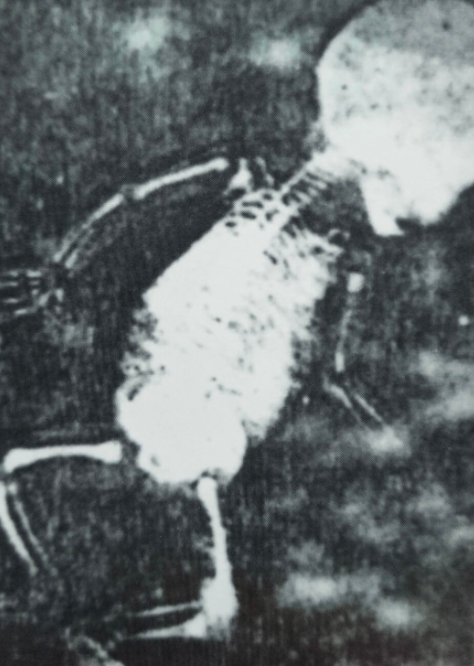 Bagside. Røntgen af baby