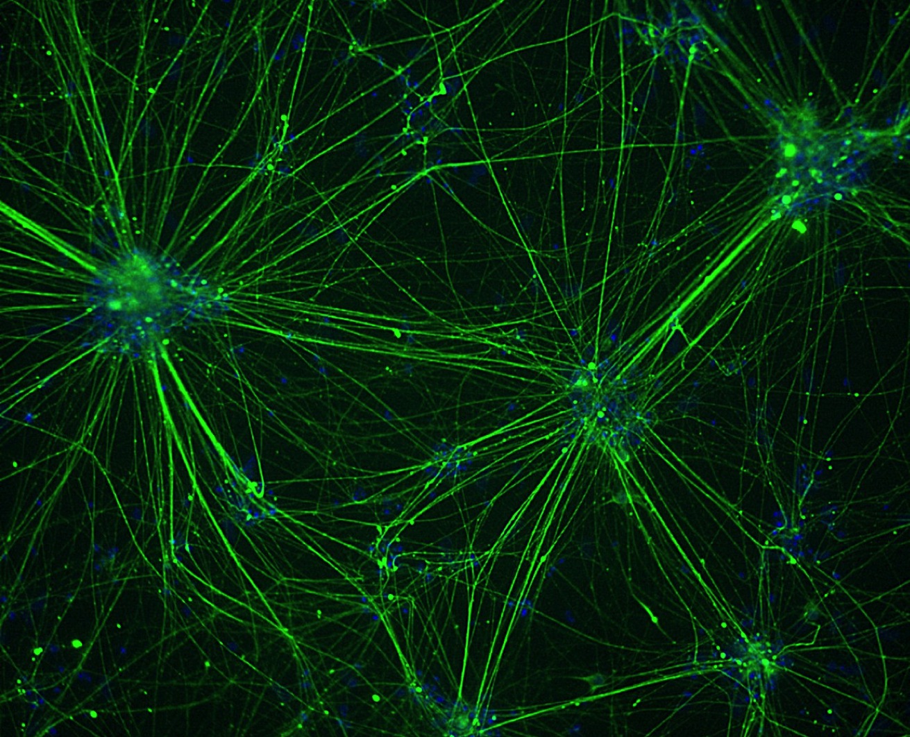 Månedens foto: Smerte